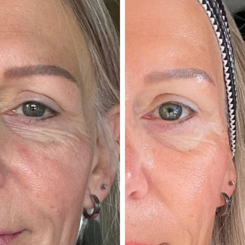 Resultados de antes e depois