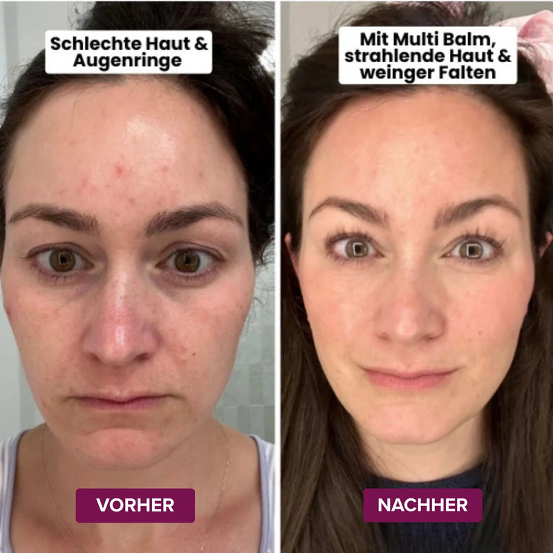 Resultados de antes e depois